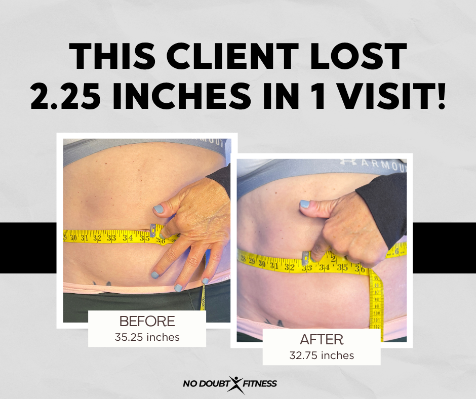 Before and after body sculpting treatment on abdomen